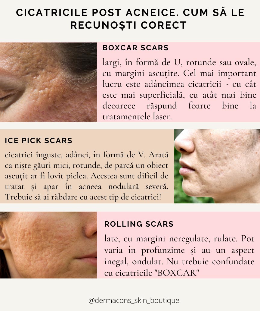 uniformizează pielea feței de cicatrici prezice gel anti-îmbătrânire pentru îngrijirea ochilor